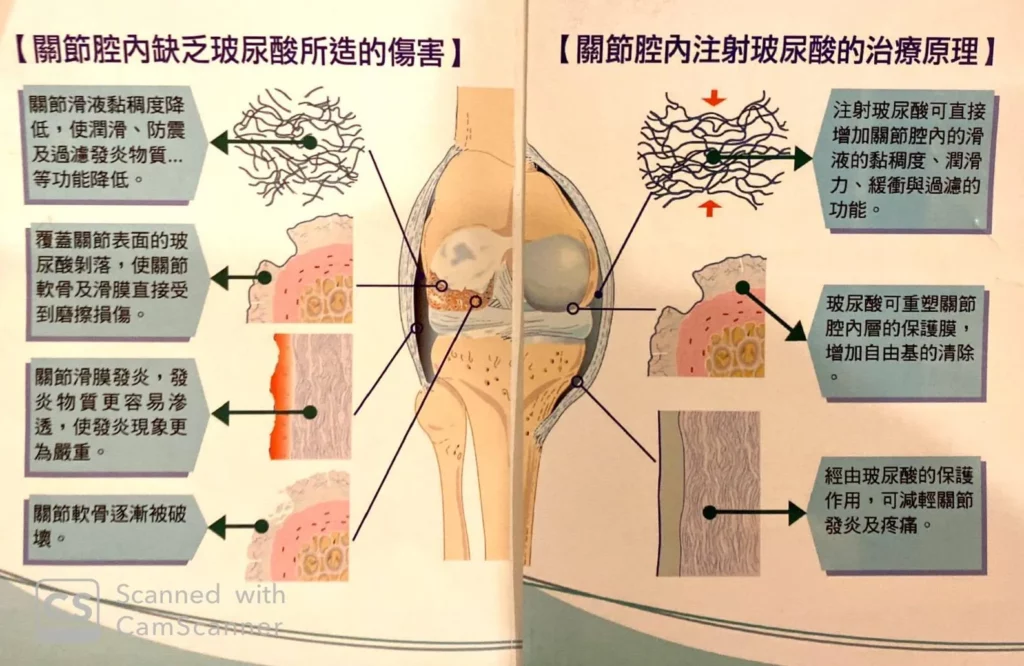 台南PRP推薦、台南震波推薦 5 imgi 11 201912020947334770