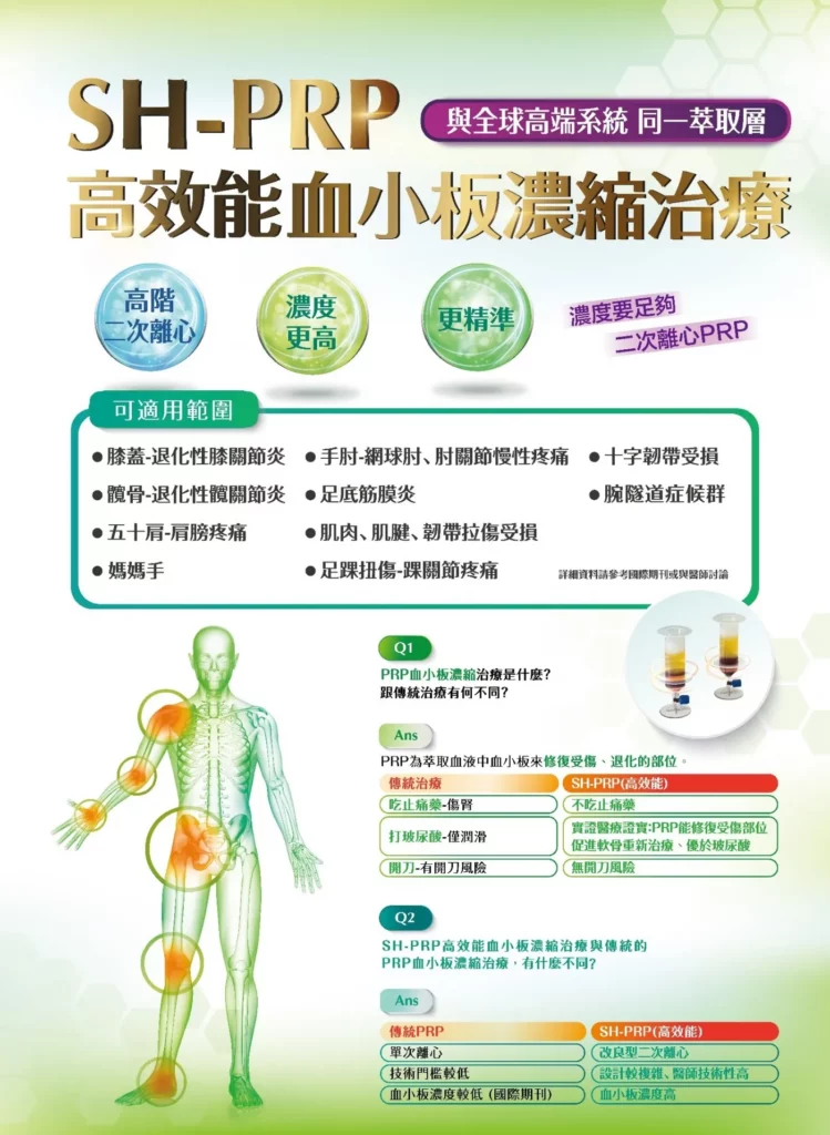 二次離心 SH-PRP介紹，可適用於膝蓋退化、網球肘、十字韌帶損傷、足底筋膜炎、腕隧道症候群、五十肩、韌帶拉傷受損、媽媽手、踝關節疼痛