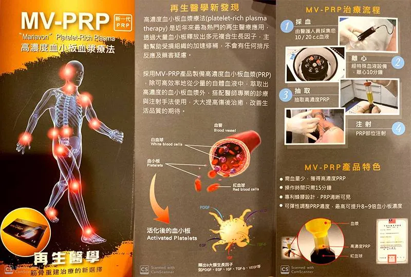 台南PRP推薦、台南震波推薦 3 imgi 9 201912020958125185