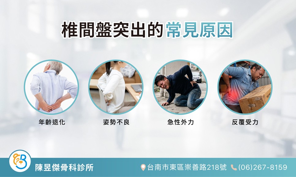 椎間盤突出一定要開刀嗎?PRP 療程、施打次數與效果說明 1 a